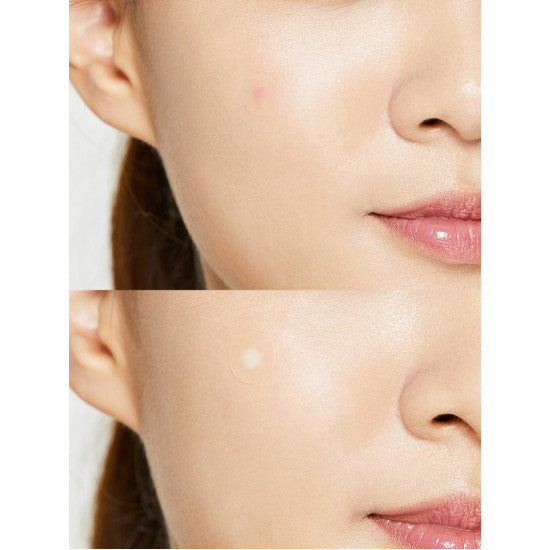 Пластыри от прыщей COSRX Acne pimple master patch 24pcs